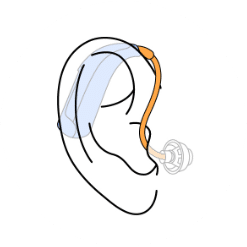 Open BTE Hearing Aid