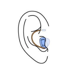 Remote hearing aids
